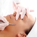 Top 5 Important Things to Look For in a Dermaplaning Provider